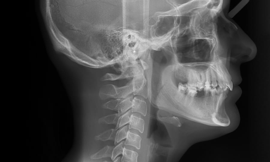 An example of a cephalometric X-ray.